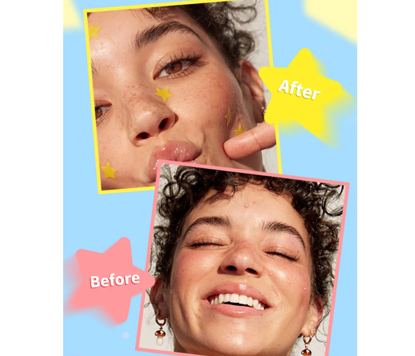 MLSMILE Star Pimple Acne Patches Sheet: #4 Green