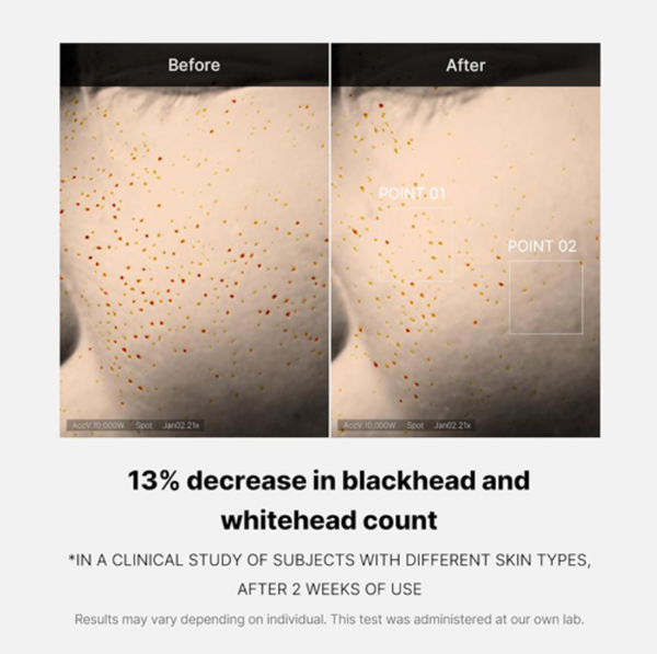 MEDICUBE Zero Pore One-day Serum