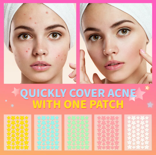 MLSMILE Star Pimple Acne Patches Sheet: #4 Green